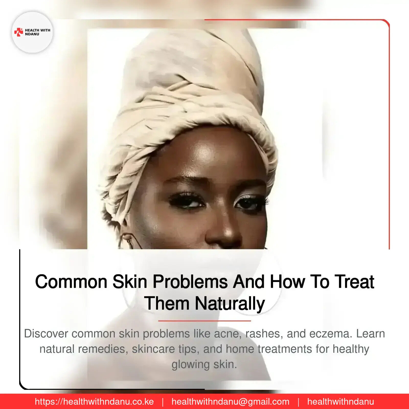 Common Skin Problems And How To Treat Them Naturally