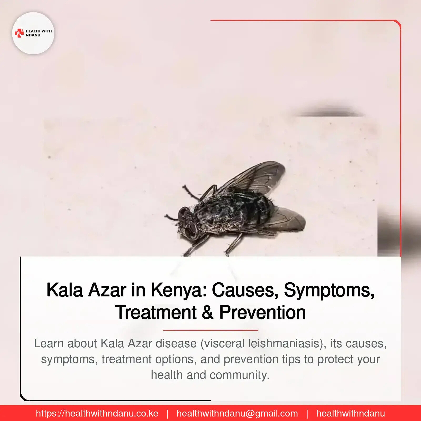 Kala Azar in Kenya: Causes, Symptoms, Treatment & Prevention