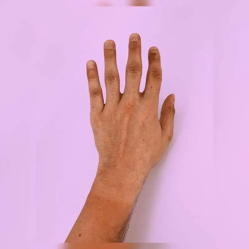 Understanding Normal and Abnormal Nail Colors