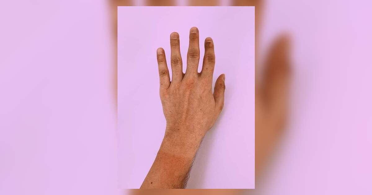 Understanding Normal and Abnormal Nail Colors