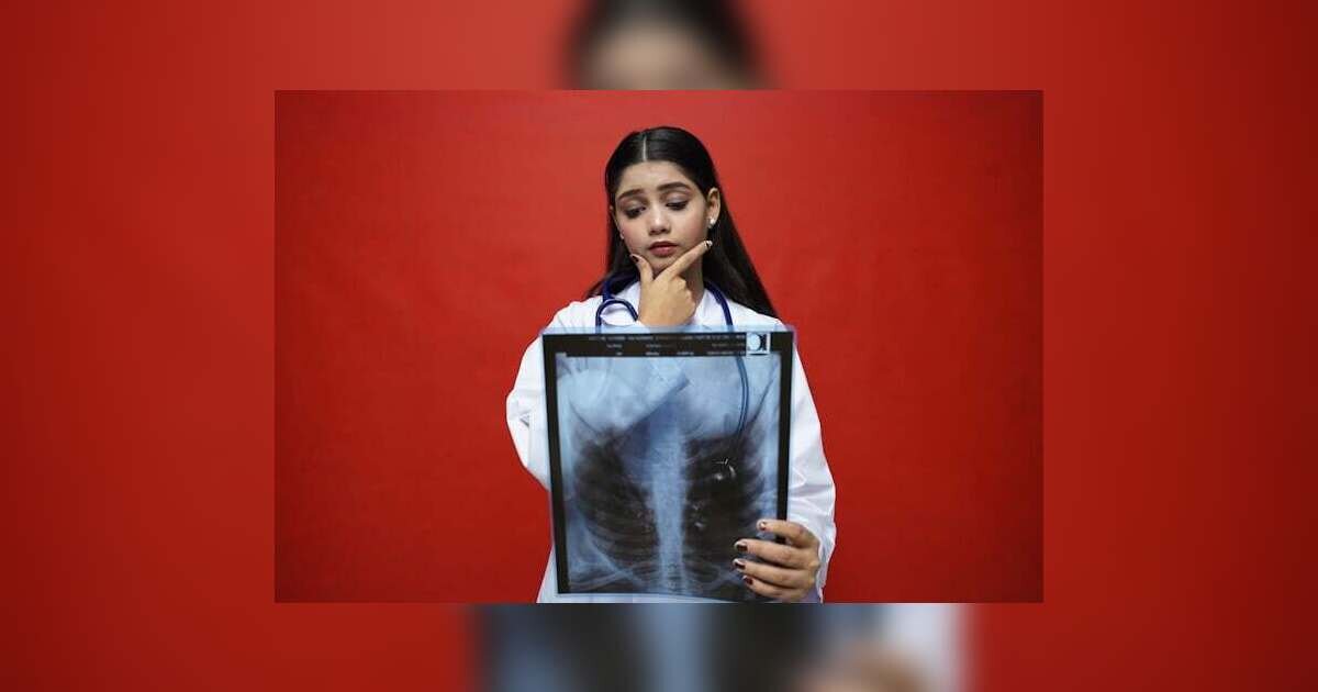 Tuberculosis (TB): Causes, Symptoms, Treatment, Prevention