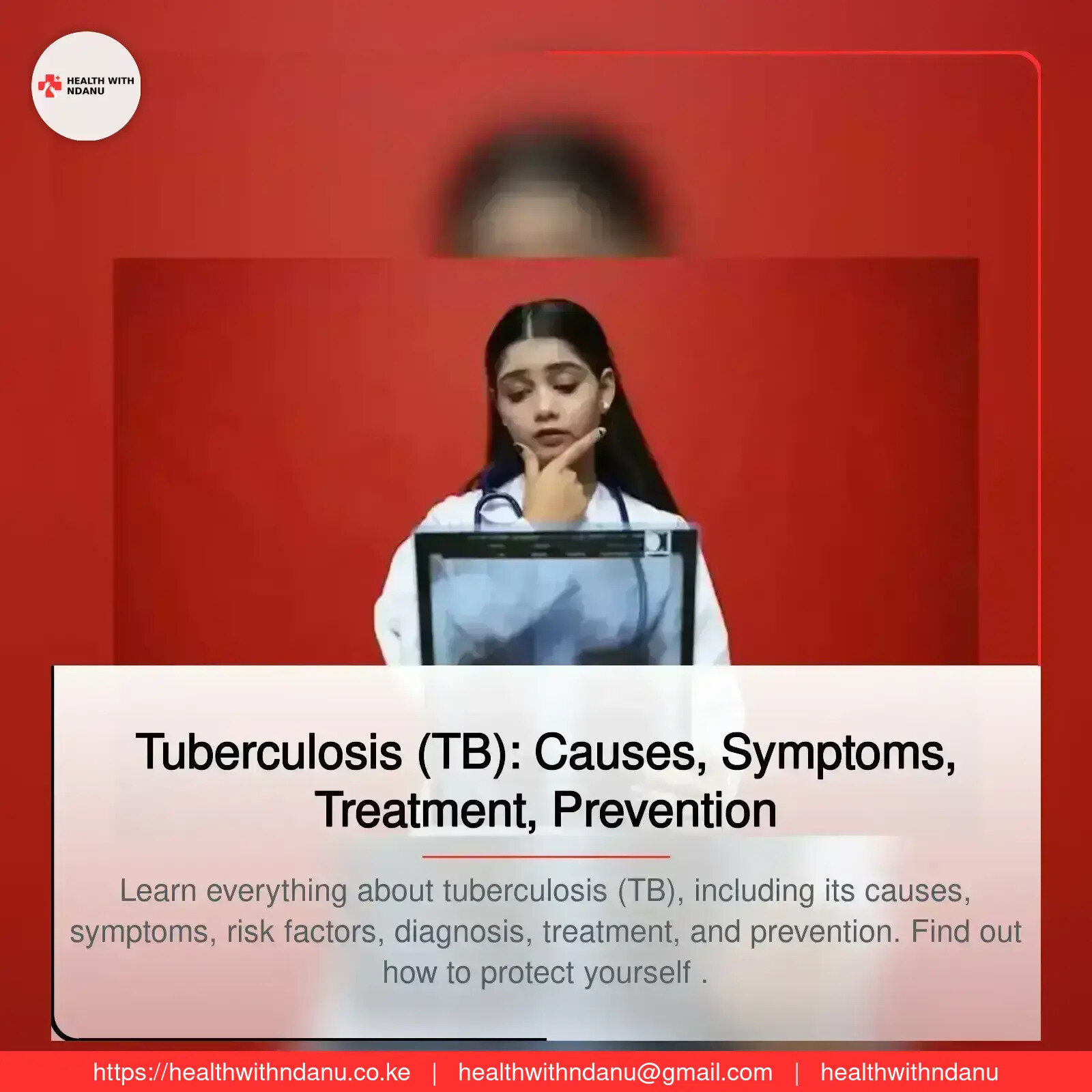 Tuberculosis (TB): Causes, Symptoms, Treatment, Prevention