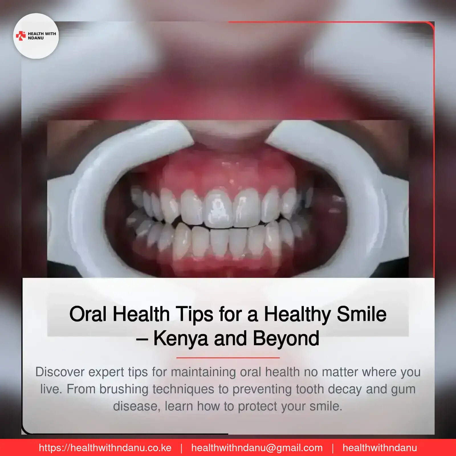 Oral Health Tips for a Healthy Smile – Kenya and Beyond
