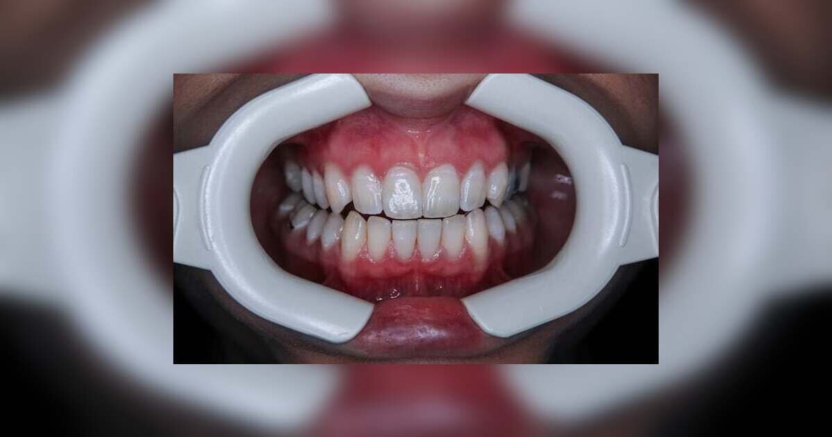 Oral Health Tips for a Healthy Smile – Kenya and Beyond