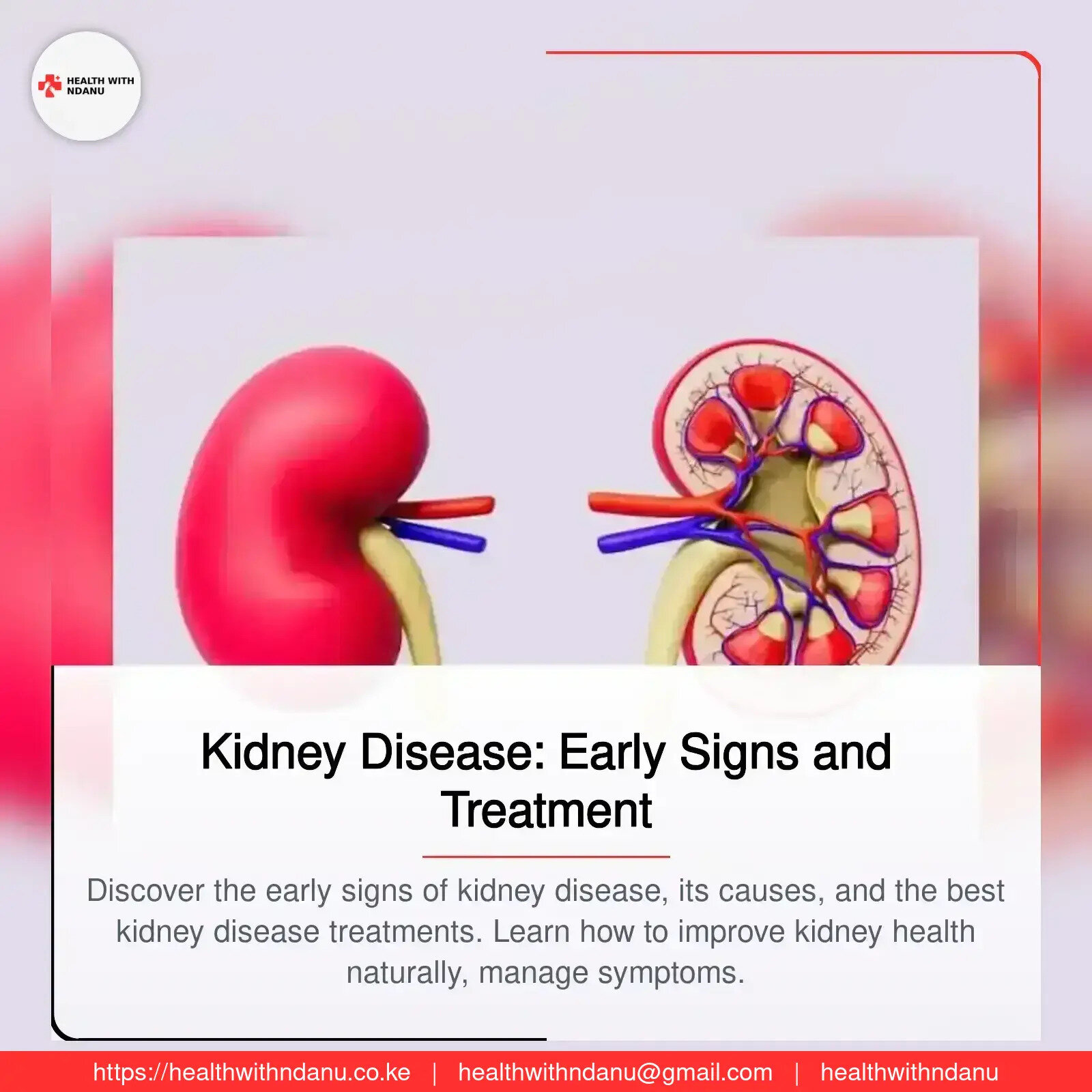 Kidney Disease: Early Signs and Treatment