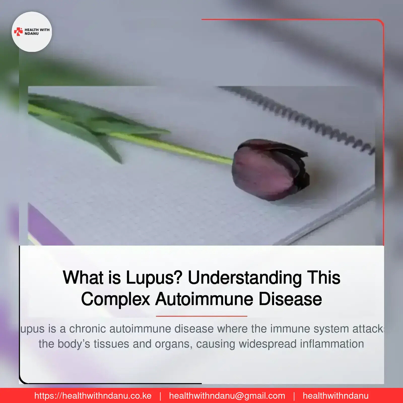 What is Lupus? Understanding This Complex Autoimmune Disease